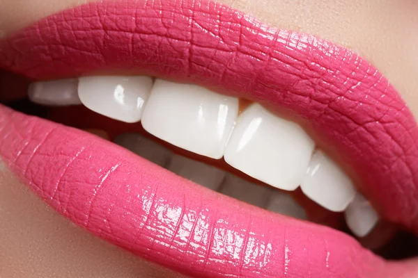Perfect smile before and after bleaching. Dental care and whitening teeth. Smile with white healthy teeth. Healthy woman teeth and smile and sexy full pink lips — Stok fotoğraf
