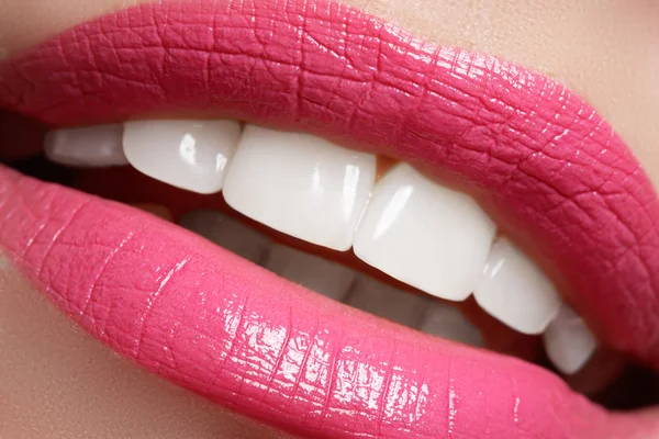 Perfect smile before and after bleaching. Dental care and whitening teeth. Smile with white healthy teeth. Healthy woman teeth and smile and sexy full pink lips Royalty Free Stock Images