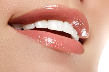 Mükemmel gülümseme öncesi ve sonrası ağartma. Diş Bakımı ve diş beyazlatma