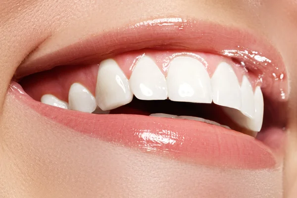 Sonrisa perfecta antes y después del blanqueamiento. Cuidado dental y blanqueamiento de dientes —  Fotos de Stock