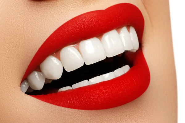 Perfekt leende efter blekning. Tandvård och vitare tänder. Stomatologi och skönhetsvård. Kvinnan ler med fina tänder. Glatt kvinnligt leende med fräsch klar hud — Stockfoto