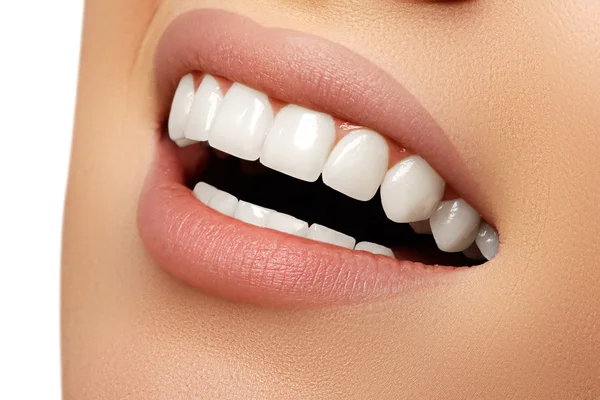 Beautiful smile of young fresh woman with great healthy white teeth. Perfect smile after bleaching. Dental care and whitening teeth — Stock Photo, Image