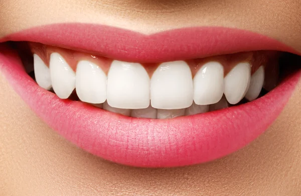 Ідеальна посмішка після відбілювання. Стоматологічний догляд та відбілювання зубів. Стоматологія та догляд за красою. Жінка посміхається з великими зубами. Весела жіноча посмішка зі свіжою чистою шкірою — стокове фото