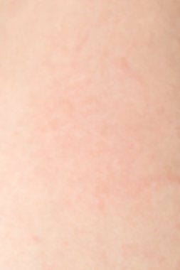 İnsan cilt dokusunu sağlıklı bel için ciltte siyah kıllar ile