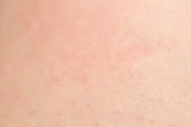 Anti insan cilt doku üzerinde siyah tüyler ile yumuşak odak