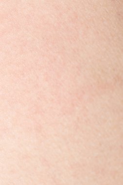 İnsan cilt dokusunu sağlıklı bel için ciltte siyah kıllar ile