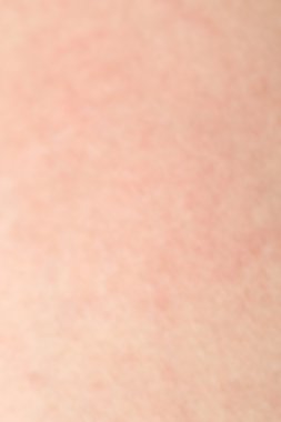 İnsan cilt dokusunu sağlıklı bel için ciltte siyah kıllar ile