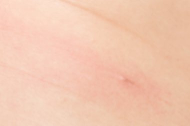 Yumuşak odak Anti göbek için insan sağlıklı cilt kavramı üzerinde