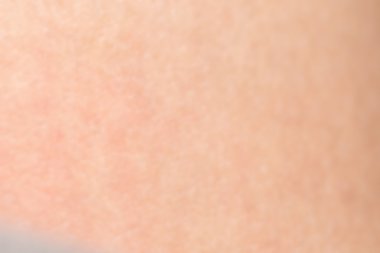 İnsan cilt dokusunu sağlıklı bel için ciltte siyah kıllar ile