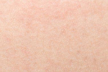 İnsan cilt dokusunu sağlıklı bel için ciltte siyah kıllar ile