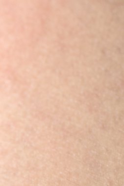 İnsan cilt dokusunu sağlıklı bel için ciltte siyah kıllar ile