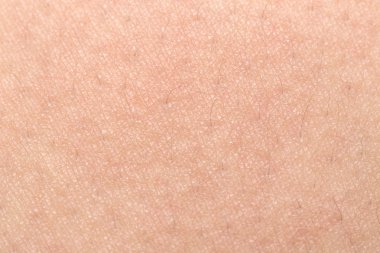 İnsan cilt dokusunu sağlıklı bel için ciltte siyah kıllar ile