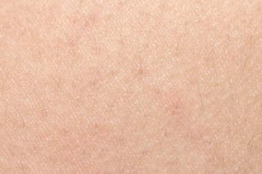 İnsan cilt dokusunu sağlıklı bel için ciltte siyah kıllar ile