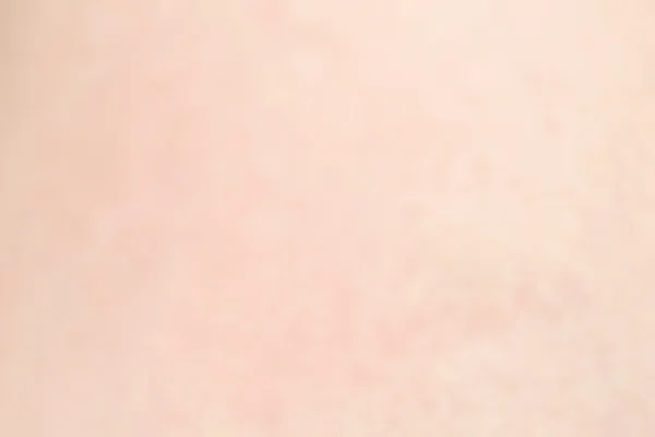 Textura de piel humana con pelos negros en la piel para una espalda sana — Foto de Stock