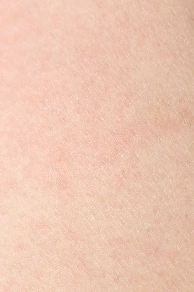 Menselijke huidtextuur met zwarte haren op de huid voor gezonde rug — Stockfoto