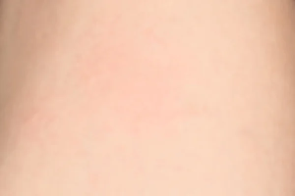 Textura de piel humana con pelos negros en la piel para una espalda sana —  Fotos de Stock