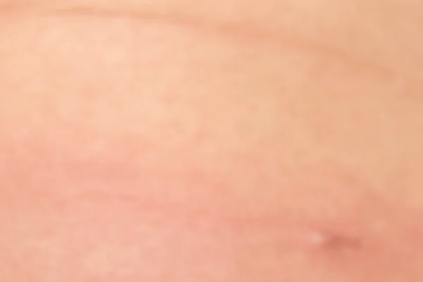 Texture de la peau humaine avec des poils noirs sur la peau pour un dos sain — Photo