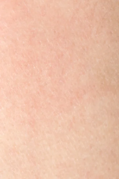健康的なバックの肌に黒い毛と人間の肌の質感 — ストック写真