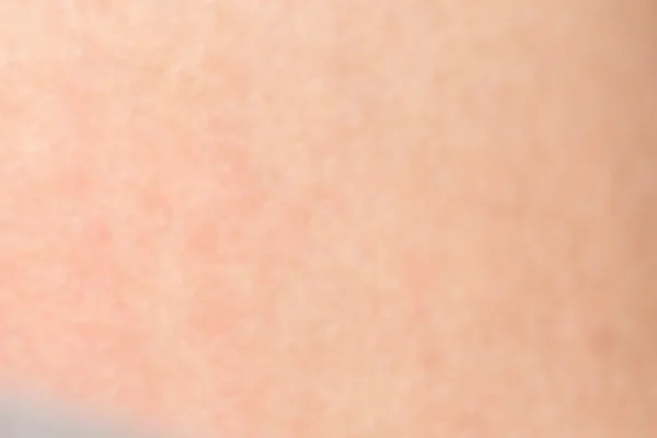 Текстура кожи человека с черными волосами на коже для здоровой спины — стоковое фото