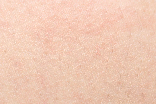 İnsan cilt dokusunu sağlıklı bel için ciltte siyah kıllar ile