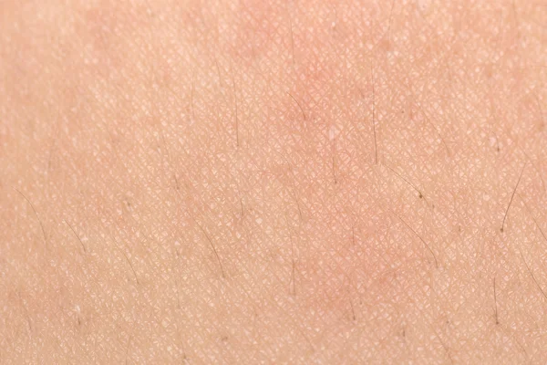 Текстура кожи человека с черными волосами на коже для здоровой спины — стоковое фото