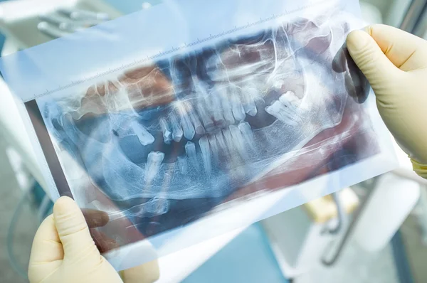 Imagem panorâmica de raios-X de dentes humanos — Fotografia de Stock