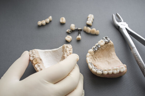 Dentist hand with jaw, other tools on background