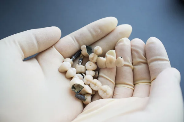 Tandläkare palms med olika proteser och kronor — Stockfoto