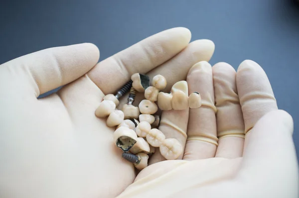 Dentist palms with different dentures and crowns — Stock Photo, Image