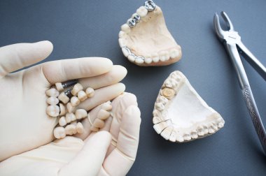 Üstten Görünüm modelleme çene düzeni