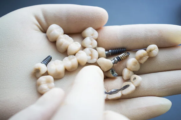 Dentista escolhendo dentadura em suas mãos closeup — Fotografia de Stock