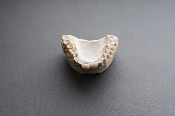 Mandíbula de yeso con dos dentaduras postizas en gris plano laico —  Fotos de Stock