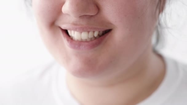 Cuidados dentários clareamento dental mulher com sobrepeso sorriso — Vídeo de Stock