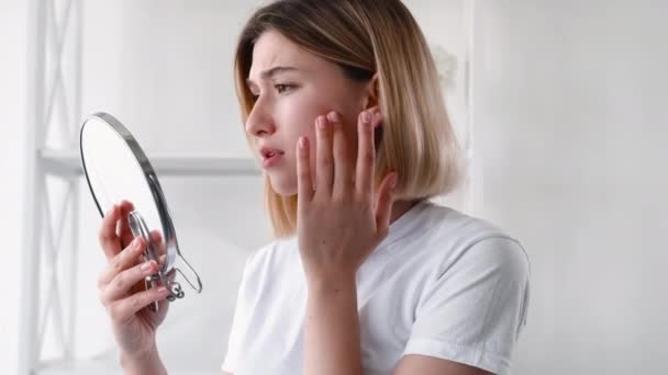 Acne behandeling huidprobleem verstoord meisje gezicht — Stockvideo