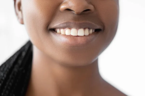 Sourire sain soins dentaires dentisterie femme dents — Photo