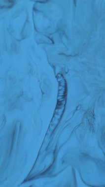 Dikey video. Mürekkep sıçraması. Damlama dokusu. Odaklanamayan mavi, beyaz, renkli, kimyasal siyah lekeler soyut arka planda yayılıyor..