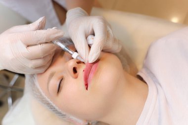 Kozmetik uzmanı dudağın üst kısmına hiyalüronik asit enjekte ederek müşterinin dudaklarının hacmini arttırır.