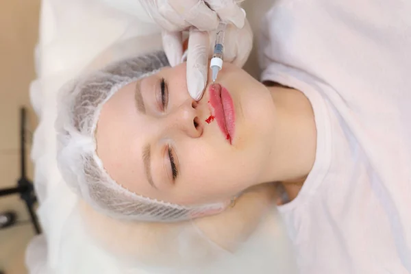 The beautician inserted a needle from the syringe all the way to its base to evenly distribute the hyaluronic acid in the client\'s lips