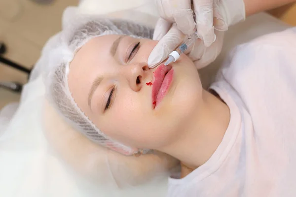 The beautician inserted a needle from the syringe all the way to its base to evenly distribute the hyaluronic acid in the client\'s lips