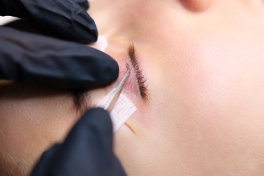 Özel bir araçla silia çalışmalarının lamination ustaları ve dönen silia için düzeltmeler