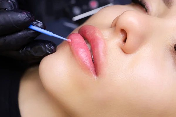 Menerapkan Anestesi Bibir Model Dengan Kuas Biru Kecil Sebelum Prosedur — Stok Foto