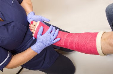 Ladies leg in Cast being treated by a Nurse clipart