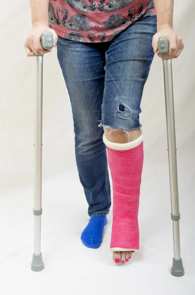 stock image Broken Leg and Crutches