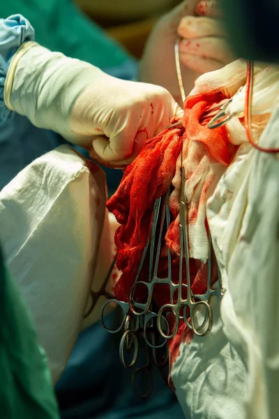 Sebész Jobb Kezének Mutatóujjával Gyógyítja Meg Sebet Sebészi Szorítók Véres — Stock Fotó