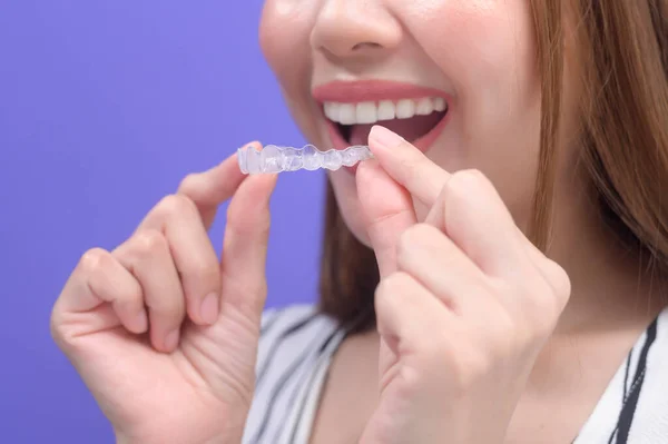 Young Smiling Woman Holding Invisalign Braces Studio Dental Healthcare Orthodontic — Stok Foto