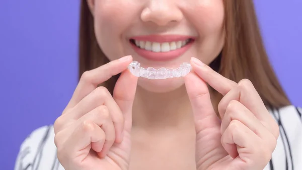 Young Smiling Woman Holding Invisalign Braces Studio Dental Healthcare Orthodontic — Stok Foto