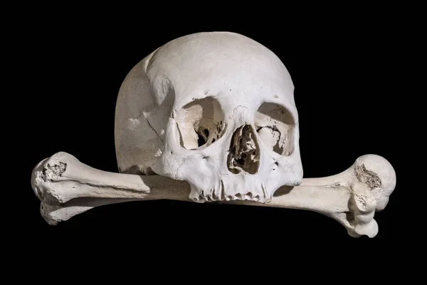 Human Skull Bones Black Background — Stock Photo, Image