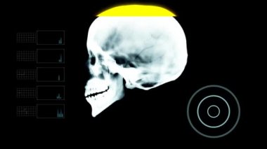Kafatası profil altında X - Ray ile diğer öğeleri