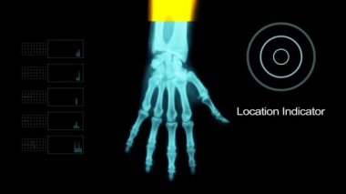 Kol profil altında X - Ray ile bazı diğer öğeler