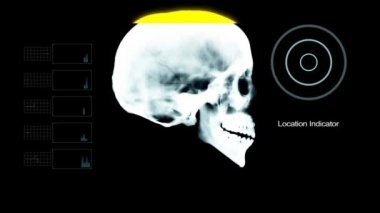 Kafatası profil altında X - Ray ile bazı Digaital öğeler